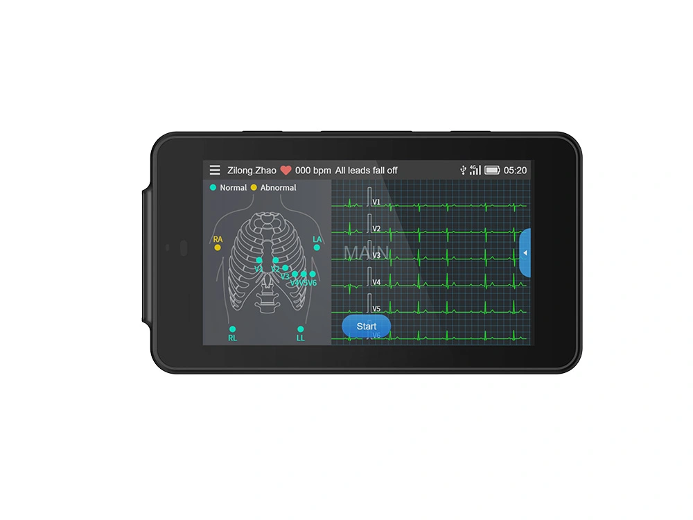 Pocket ECG